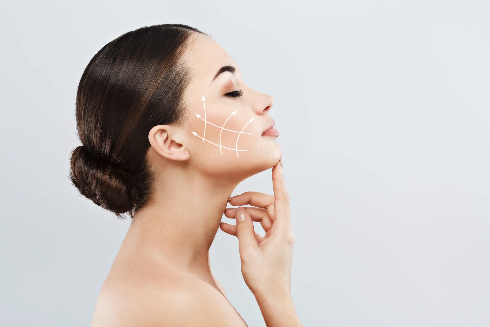 Résultat de lifting cervico-facial — Dr Pulvermacker, Paris 16