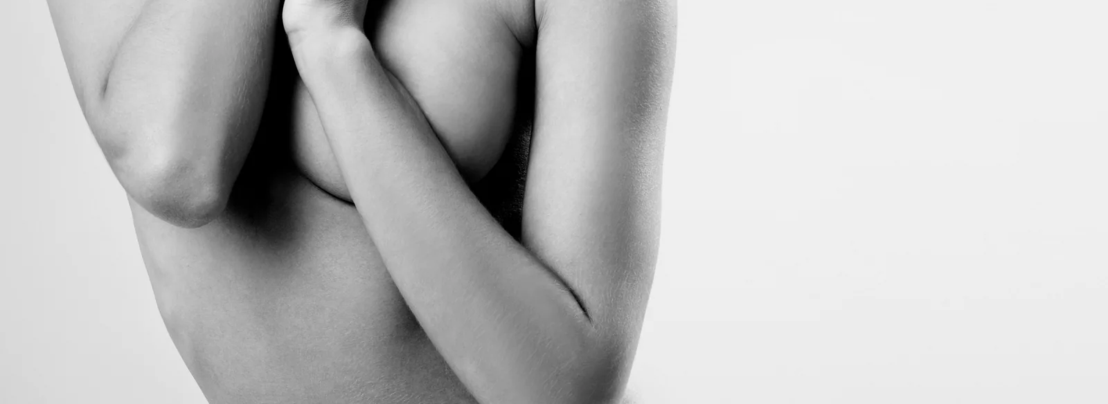 Patiente enlaçant ses bras affinés, illustrant les résultats d'un lifting des bras (brachioplastie) réalisé par le Dr Pulvermacker à Paris