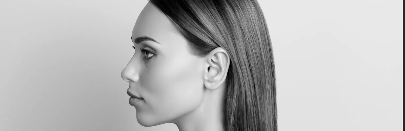 Profil d'une patiente mettant en valeur la forme de l'oreille, illustrant une otoplastie réalisée par le Dr Pulvermacker à Paris